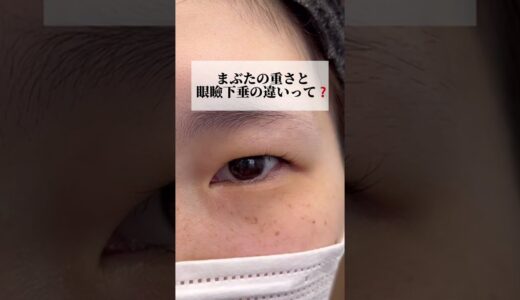 【二重整形】まぶたの重さと眼瞼下垂の違いについて解説　#shorts