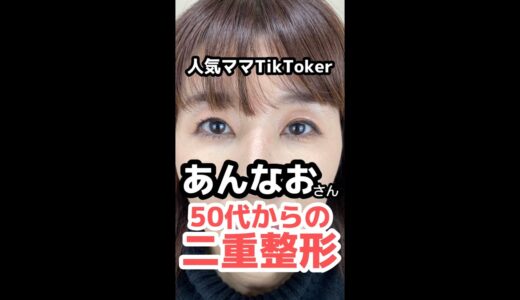 【美魔女】50代からの二重整形