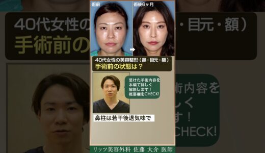 目、鼻の美容整形を受けた40代女性の手術内容を解説します！手術前の状態は？