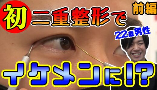 【イケメン変身企画】前髪でなるべく隠していた一重。二重整形ではたして男性はイケメンになれたのか？埋没二重/二重にする方法【湘南美容クリニック】