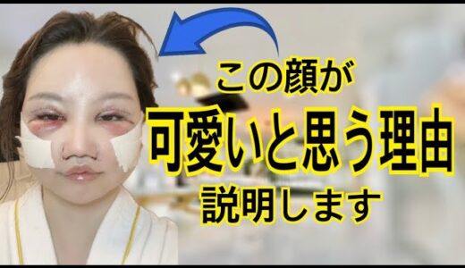 【美容整形ダウンタイム】だんだん顔伸びてきてツラいんだけど。