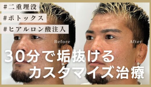 【二重埋没】総合格闘家が初めて美容整形を受けてみた！〜カウンセリングから施術まで全て公開〜