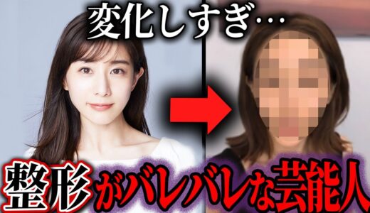 【ゆっくり解説】変形しすぎ！整形バレバレな芸能人20選