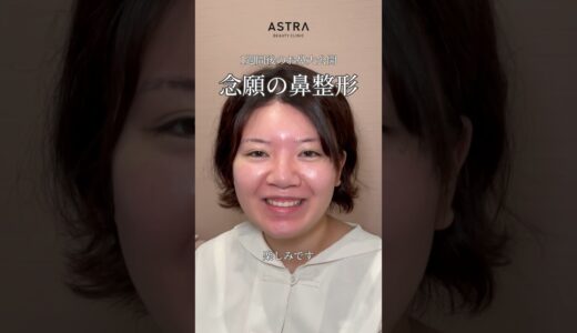 【施術から1週間後を大公開‼️】 #astrabeautyclinic #美容整形 #アストラビューティクリニック #忘れ鼻 #鼻整形 #小鼻縮小