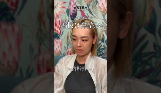 【ナチュラルだけど垢抜け美人へ】 #astrabeautyclinic #美容整形 #鼻整形 #忘れ鼻 #アストラビューティクリニック #小鼻縮小