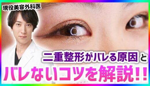 【整形失敗】二重整形バレる？バレないコツを美容外科医が解説！【二重埋没】