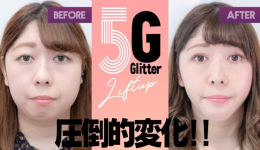 【全部見せます！美容整形Before⇒After】小顔になりたいなら5Gリフト【圧倒的変化‼︎】30代編