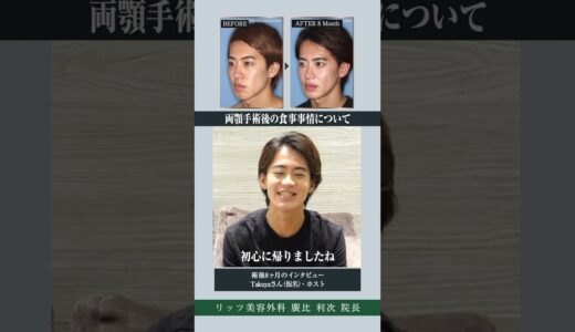 【20代男性の美容整形】両顎手術後の食事事情について