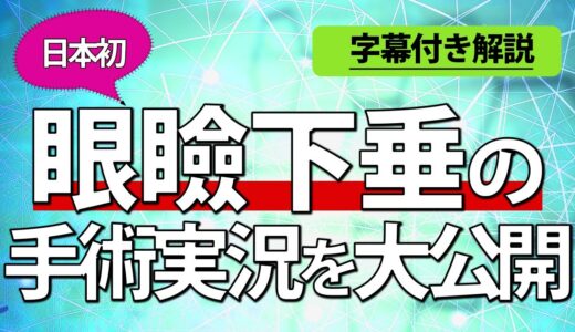 【美容整形】日本初、眼瞼下垂の手術実況を大公開！手術直後の腫れ具合まで赤裸々に！（字幕あり）