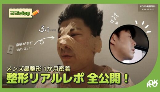 【KOKO美容外科】メンズ鼻整形VLOG リアルレポ！ㅣ手術前～手術1か月後