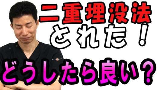 【二重整形】埋没法したのに二重が取れる場合はどうすればいい？美容外科医が徹底解説‼️【整形】