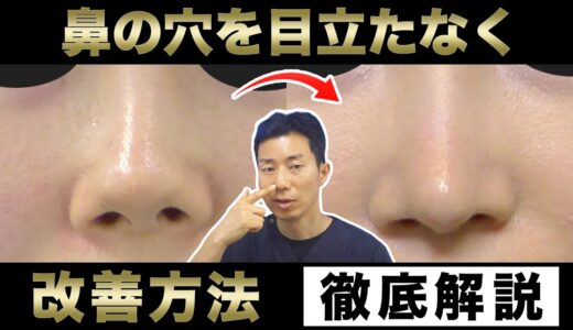 鼻の穴を目立たなくする方法を解説【美容整形】