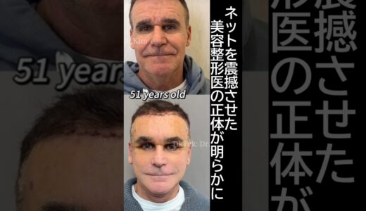 ドクターキム？tiktokで有名な美容整形医の正体が晒される#美容整形