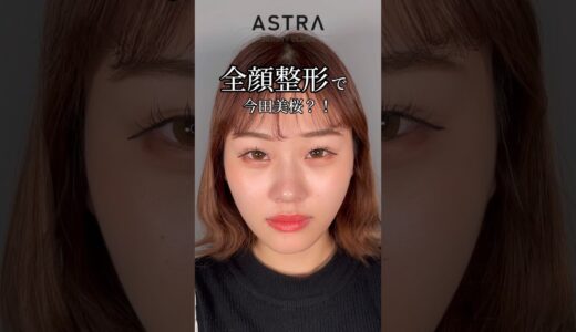 【全顔整形でナチュラル美女爆誕💖】 #アストラビューティクリニック #astrabeautyclinic #美容整形 #忘れ鼻 #鼻整形 #整形ビフォーアフター