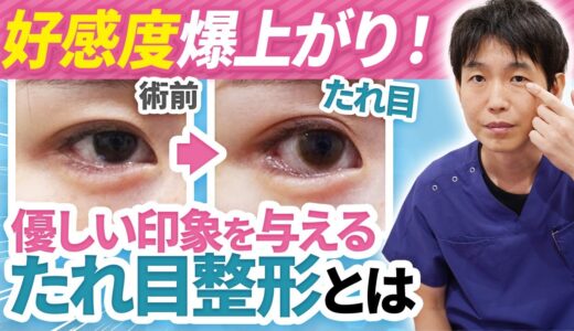 たれ目整形で人生が変わる？【目元整形｜美容整形】