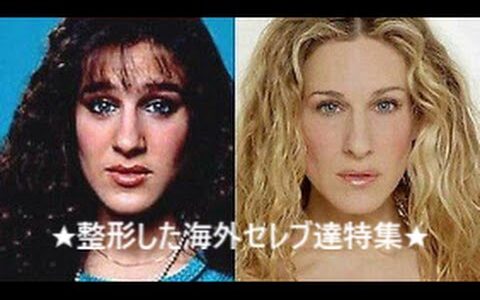 【衝撃】■美容整形は当たり前!?　海外セレブ達　整形前と整形後　ハリウッド映画スター