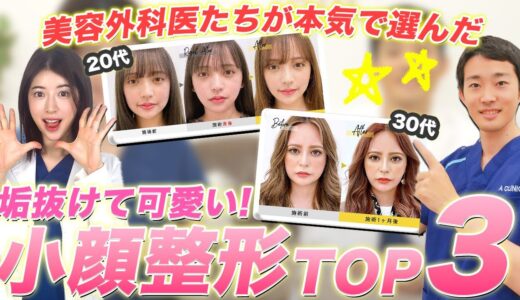 【垢抜け】美容外科医たちが厳選！切らない小顔整形TOP3！