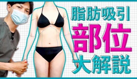 【美容整形】脂肪吸引の部位を大解説します！【部分痩せ】