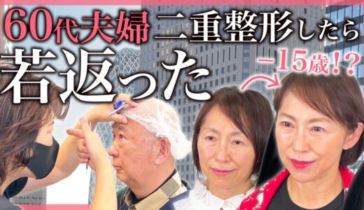 【シニア二重】68歳＆61歳が切らないまぶたのリフトアップをしたら衝撃若返り！埋没法だけで世界が変わる【埋没法】