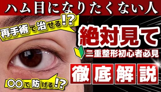 【他院修正】整形失敗！？ハム目になってしまった二重を修正手術！果たしてその結果は…？ 【湘南美容クリニック】