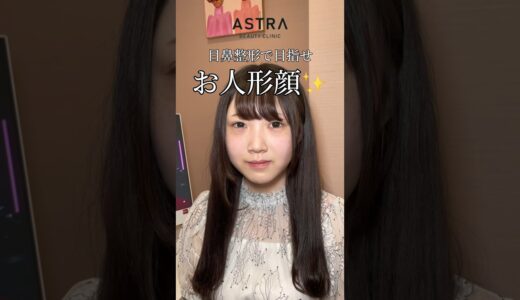 目と鼻整形でドーリーフェイス💖.#astrabeautyclinic  #アストラビューティークリニック #塩満恵子 #鼻整形 #美容整形 #忘れ鼻 #似合わせ鼻 #骨格似合わせ鼻