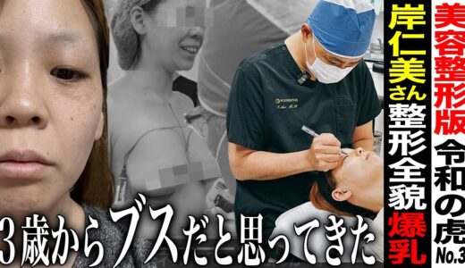 【整形編】3歳からブスだと思って生きてきた志願者が、眼瞼下垂と豊胸手術を受けて、Gカップ爆乳のぱっちりした目元に大変身┃岸 仁美┃ 3人目┃美容整形版令和の虎【東京美容外科】