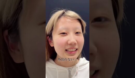 【全顔整形】地雷系女子の全顔整形　#shorts