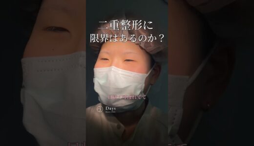 【二重整形/目頭切開】目元のフル整形で激変！#shorts