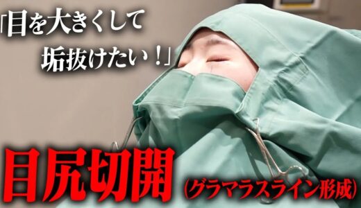 【垂れ目整形】吊り目で悩む患者様を救った美容整形術 を大公開！！