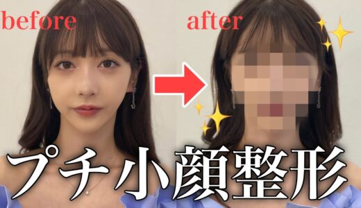 【休日密着】美容・整形のメンテナンスで可愛いをアップデートしてます💕