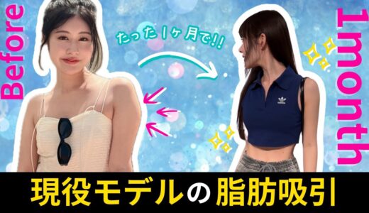 【二の腕痩せ】現役モデルの美容整形に密着！ダウンタイムを短くする方法とは？