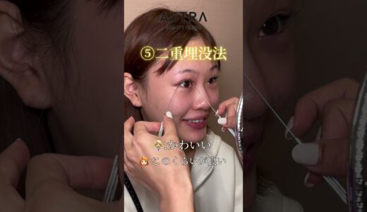 大成功全顔整形🩷#astrabeautyclinic  #アストラビューティークリニック #塩満恵子 #鼻整形 #美容整形 #忘れ鼻 #鼻尖形成#耳介軟骨移植#小鼻縮小#鼻プロテーゼ#二重埋没