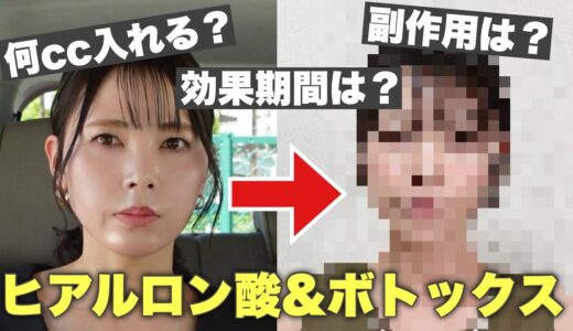 【40代からの美容医療】切らない美容整形受けてきた。ヒアルロン酸&ボトックス注射/メリットデメリットも聞いてきた！