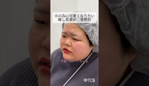 【二重整形】夫の為に可愛くなりたい 癒し系妻が二重整形 #shorts