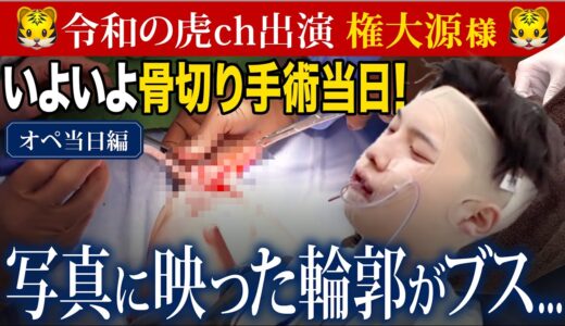 【美容整形版令和の虎】※切った骨を取り出すシーンがあります※権大源様骨切り手術当日に密着！【オペ当日】