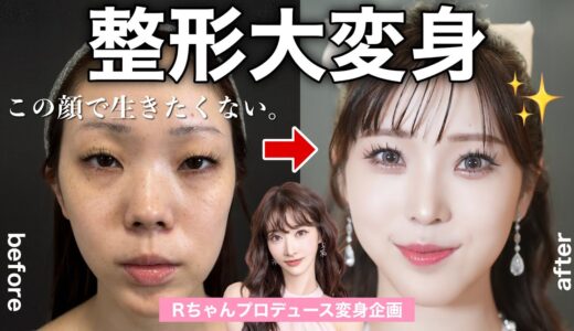 【大変身】”この顔で生きれない。”整形で視聴者さんを仰天チェンジ！