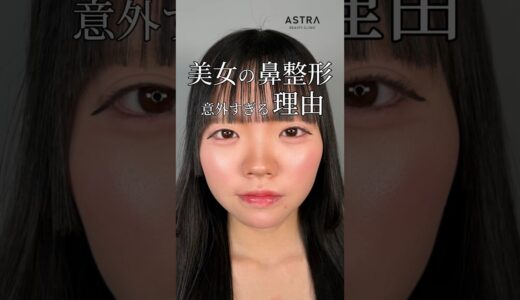 【美女が整形する理由とは…？】#アストラビューティークリニック #美容整形 #塩満恵子 #整形 #鼻整形