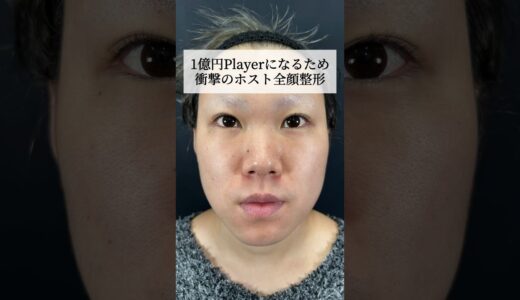 【全顔フル整形】1億円playerになるため、衝撃のホスト全顔整形 #shorts