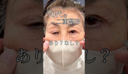 【二重整形】70代で二重整形できる？ #shorts