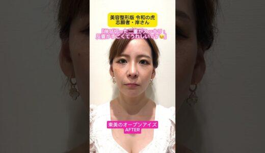 【令和の虎】美容整形の力で変えられる未来がある #東京美容外科 #美容整形 #眼瞼下垂 #オープンアイズ