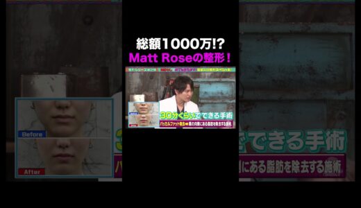 総額1000万!? Matt Rose氏の整形事情とは ｜#ななにー #稲垣吾郎 #草彅剛 #香取慎吾