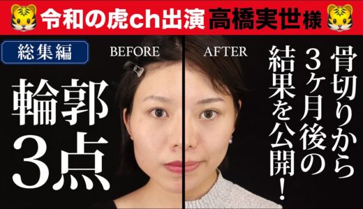 【美容整形版令和の虎】高橋実世様の生まれ変わった姿を公開！【術後3か月密着】