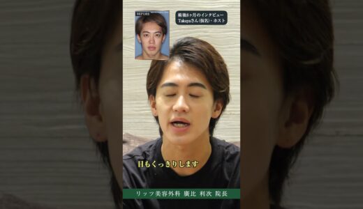 【20大男性の美容整形】両顎手術を受けたホストの術後感想