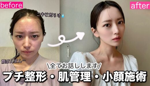 【おすすめ美容施術】本当に効果のあったもの、なかったもの全て話します！美肌・プチ整形・リフトアップ施術…