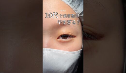 【二重整形】10代で美容整形 早すぎる？#shorts