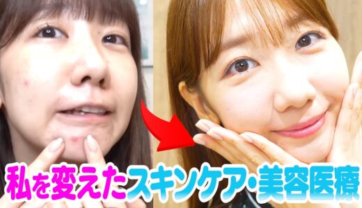 【美容医療】初！やってよかった美容医療・スキンケアをお話しします！