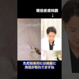 【超ｽｯｷﾘ!!】連続角栓除去を皮膚科医が解説 #shorts