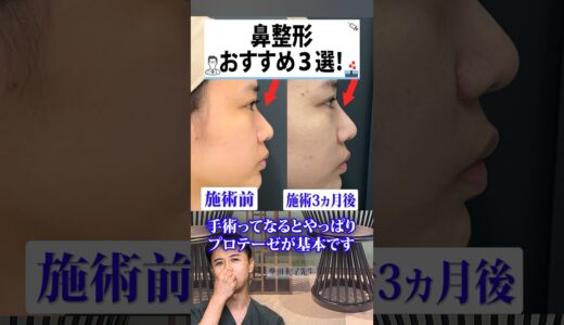 【鼻整形】おすすめ3選