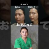 【よくわかる　おでこ整形（脂肪注入/ヒアルロン酸） 症例解説】BIANCA CLINIC