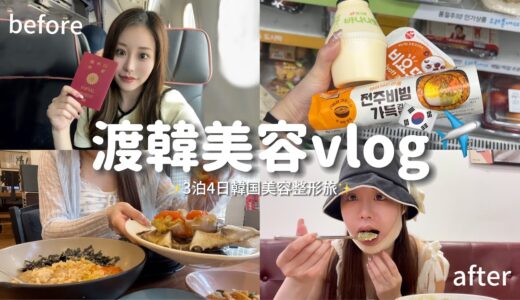 【美容vlog】韓国美容旅🇰🇷✈️輪郭脂肪吸引してきた✨|美容整形|輪郭整形|渡韓美容|カンジャンケジャン|聖水駅|明洞|カロスキル|ショッピング|女子旅|韓国グルメ|ソウルグルメ|ソウル|